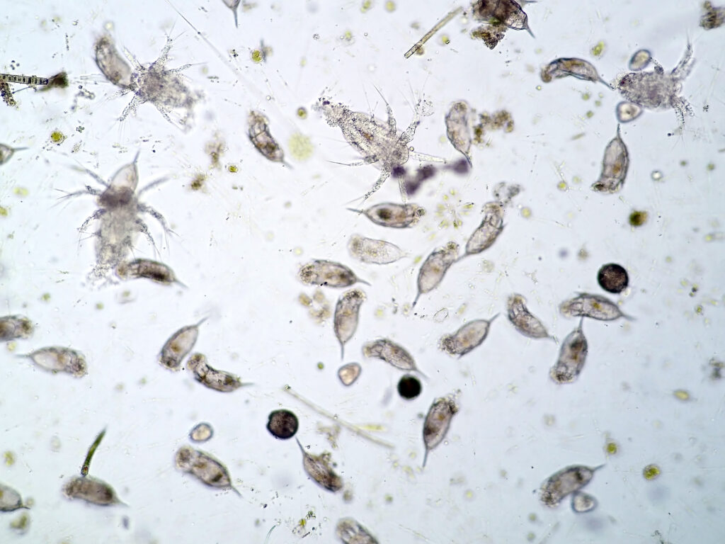 microorganisms in pond water under microscope